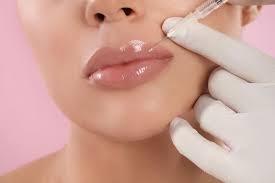 Labios